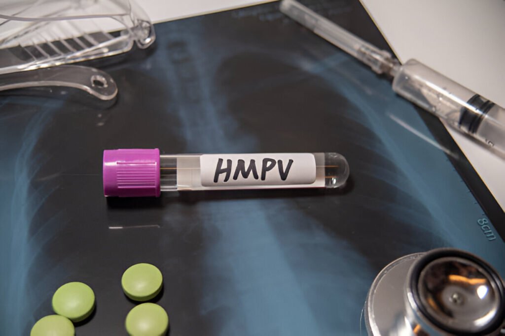 فيروس HMPV الصين: الأعراض وطرق الانتشار فيروس HMPV الصين تهديد جديد للصحة العامة؟